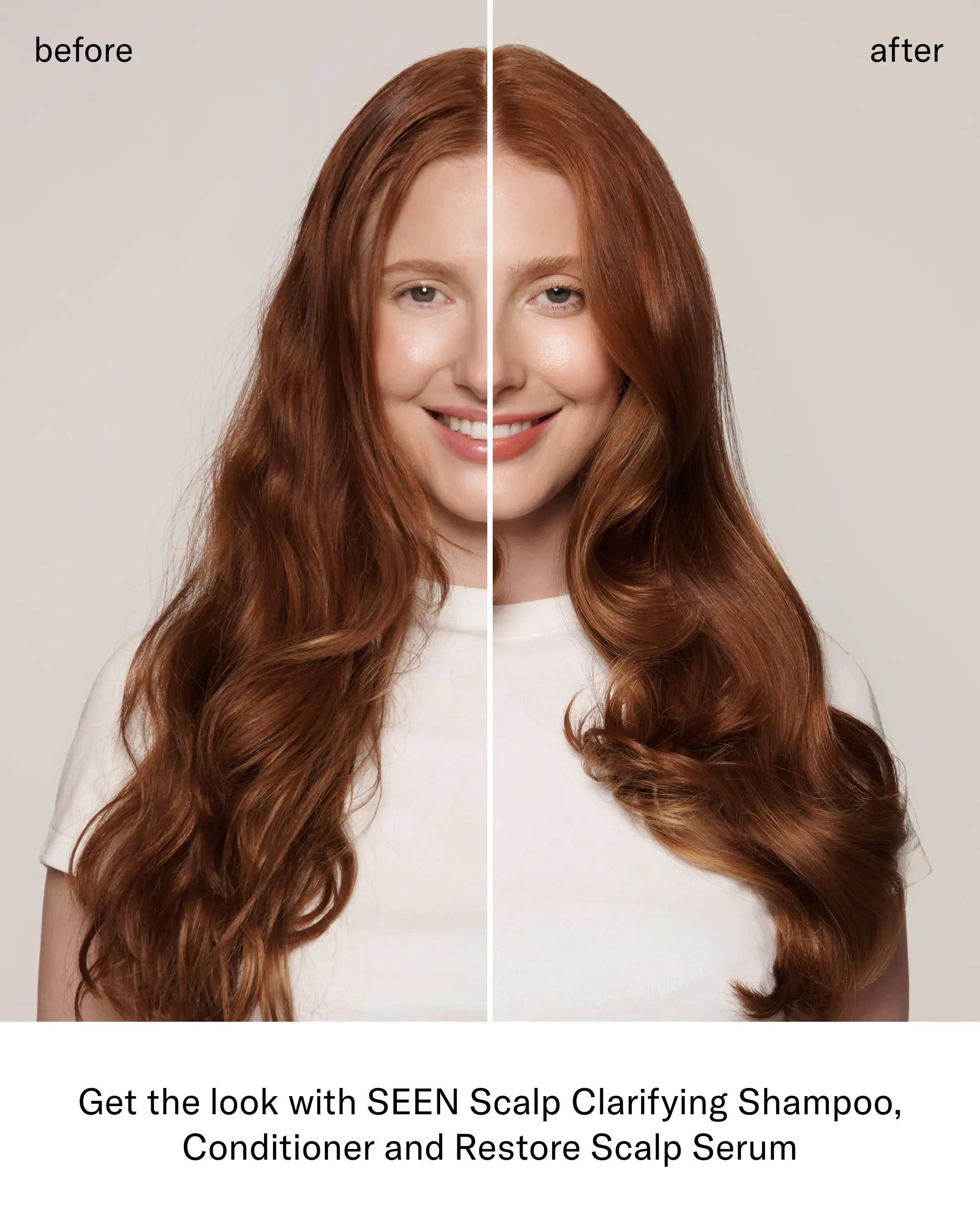 SEEN Healthy Scalp Bundle, Fragrance Free - Image 6